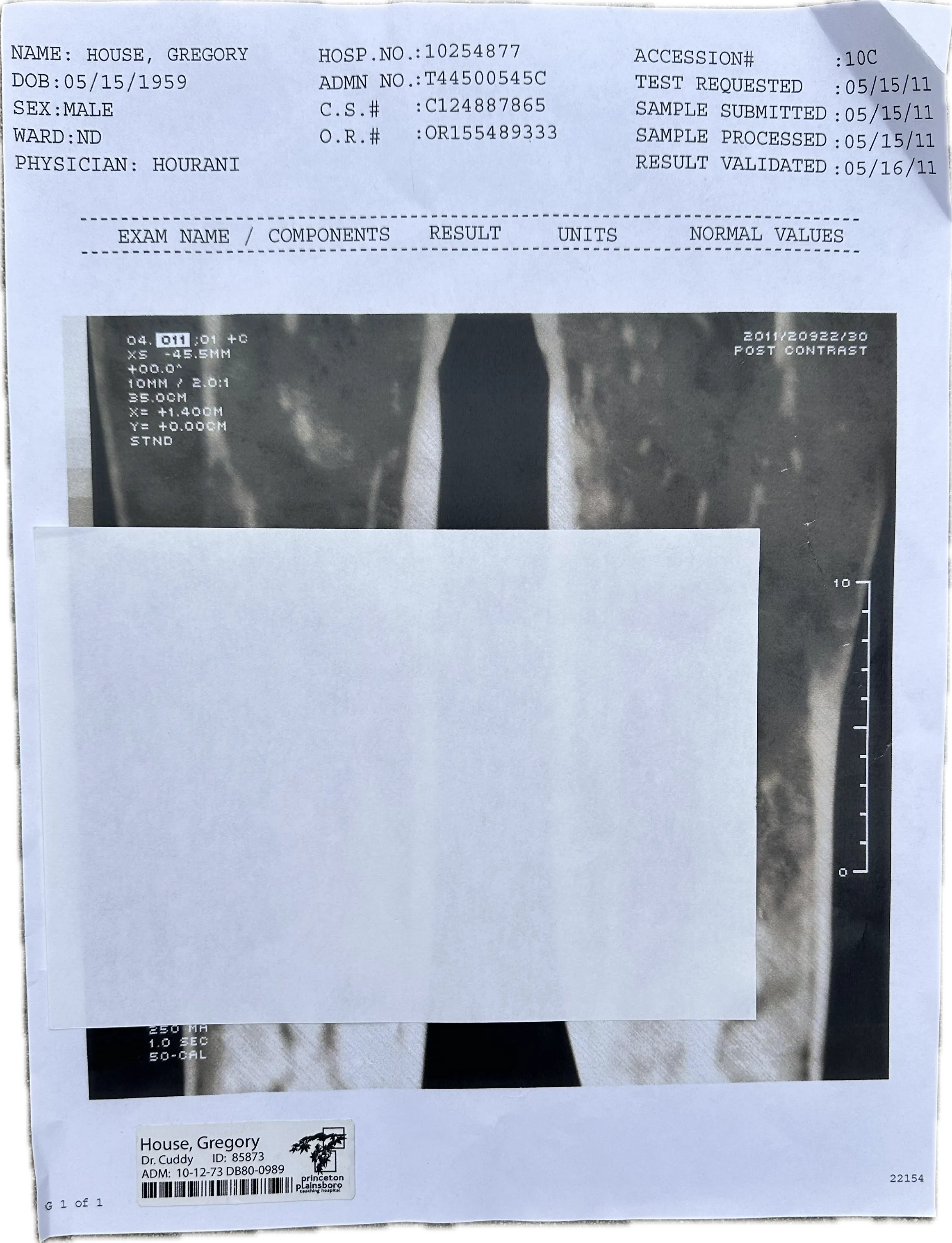 House: Dr. Gregory House's Leg X-Ray on poster board